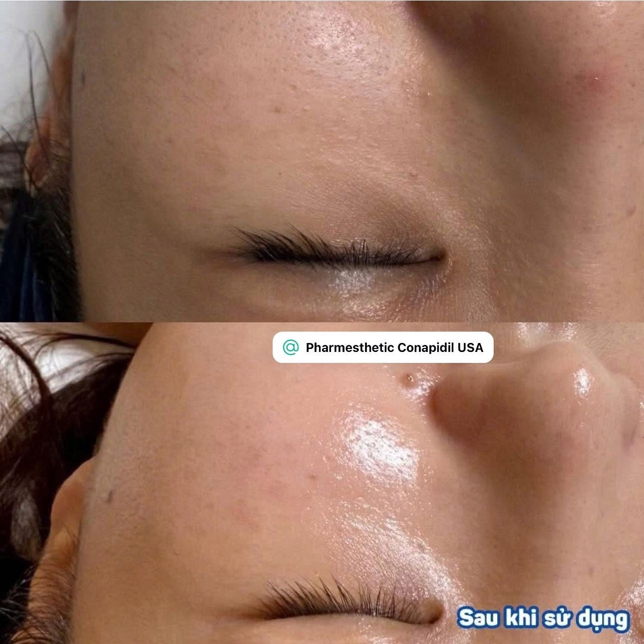 Pharmesthetics Cemenzal High Potency Cream-50mL Upgraded