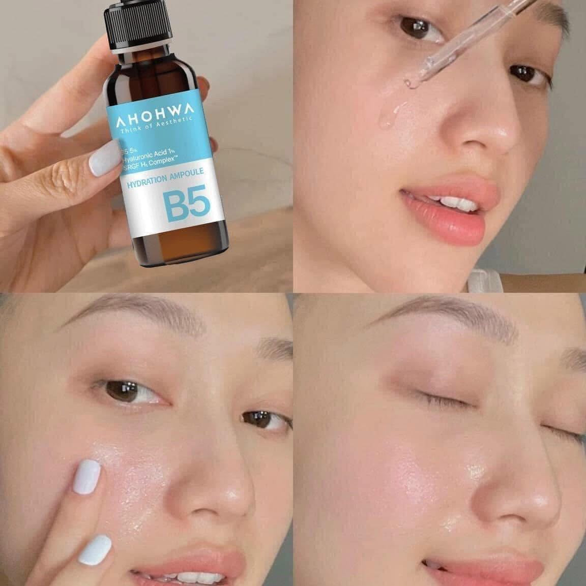 TINH CHẤT HYDRATION B5 AHOHWA 50ml