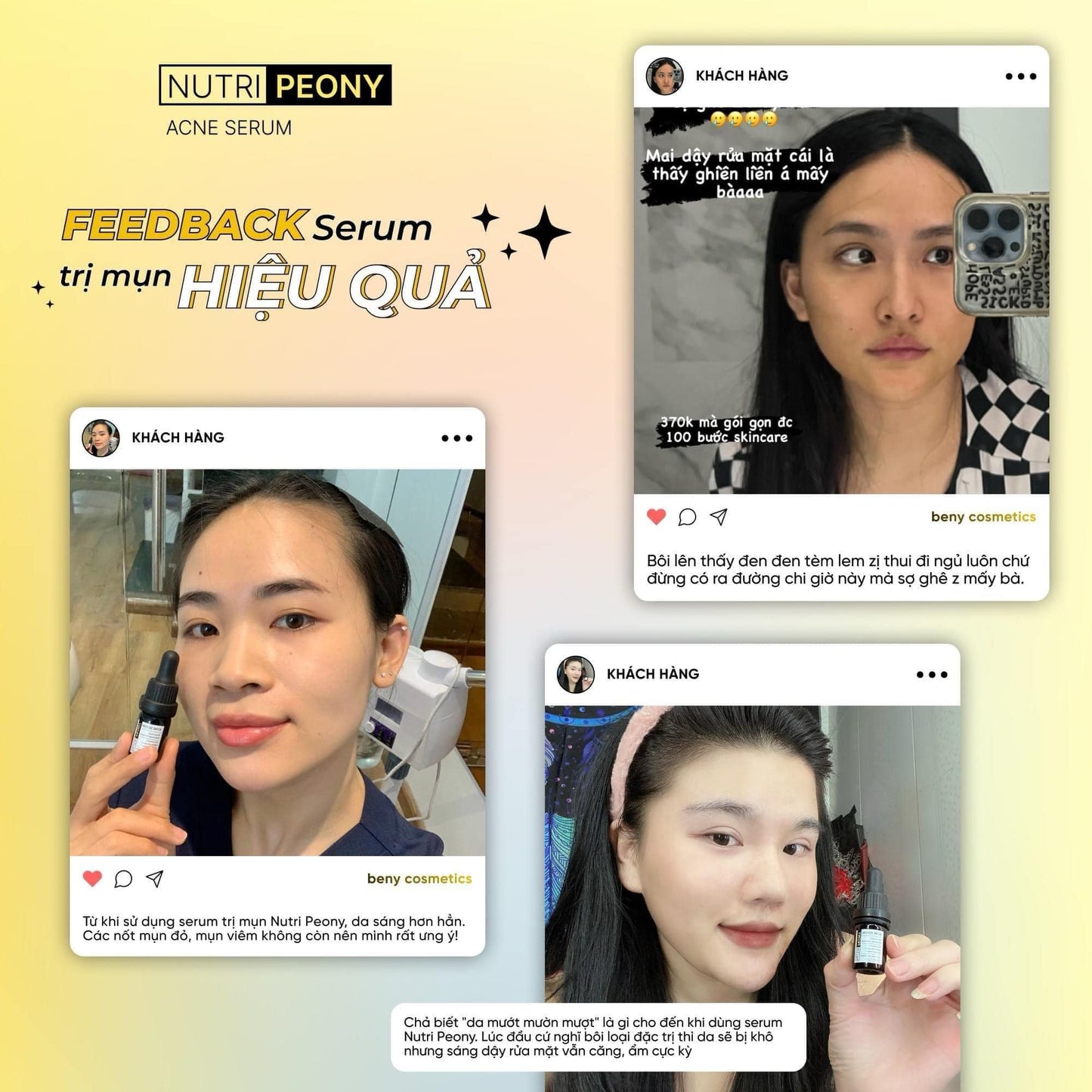 Acne Serum Rosie Center - Serum Trị Mụn NUTRIPEONY