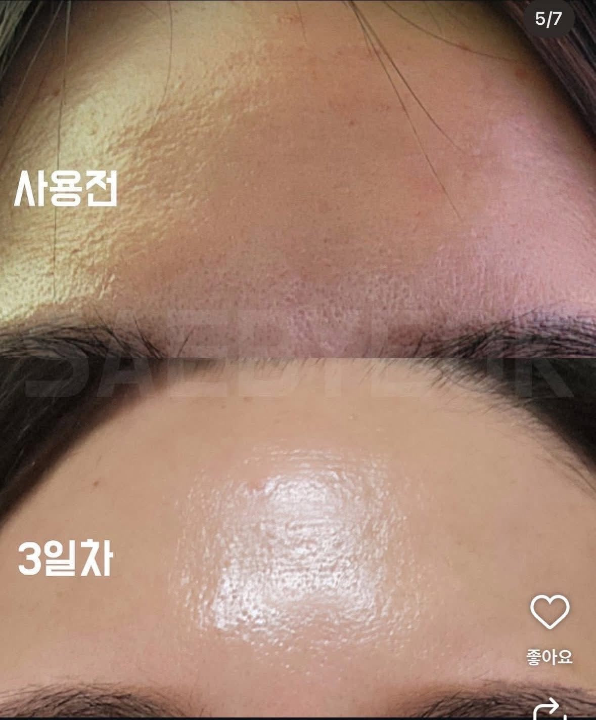 Cochalla set điều trị vấn đề da ngày đêm ngắn gọn bước mụn nám tàn nhang đốm nâu sắc tố