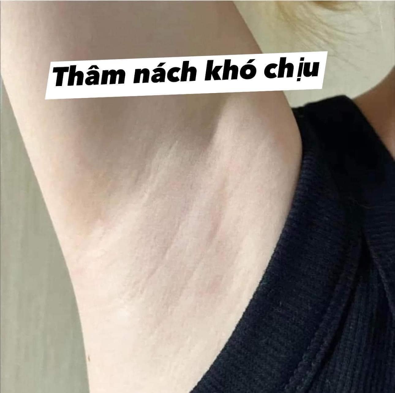 Tinh Chất Serum Trị Thâm Body