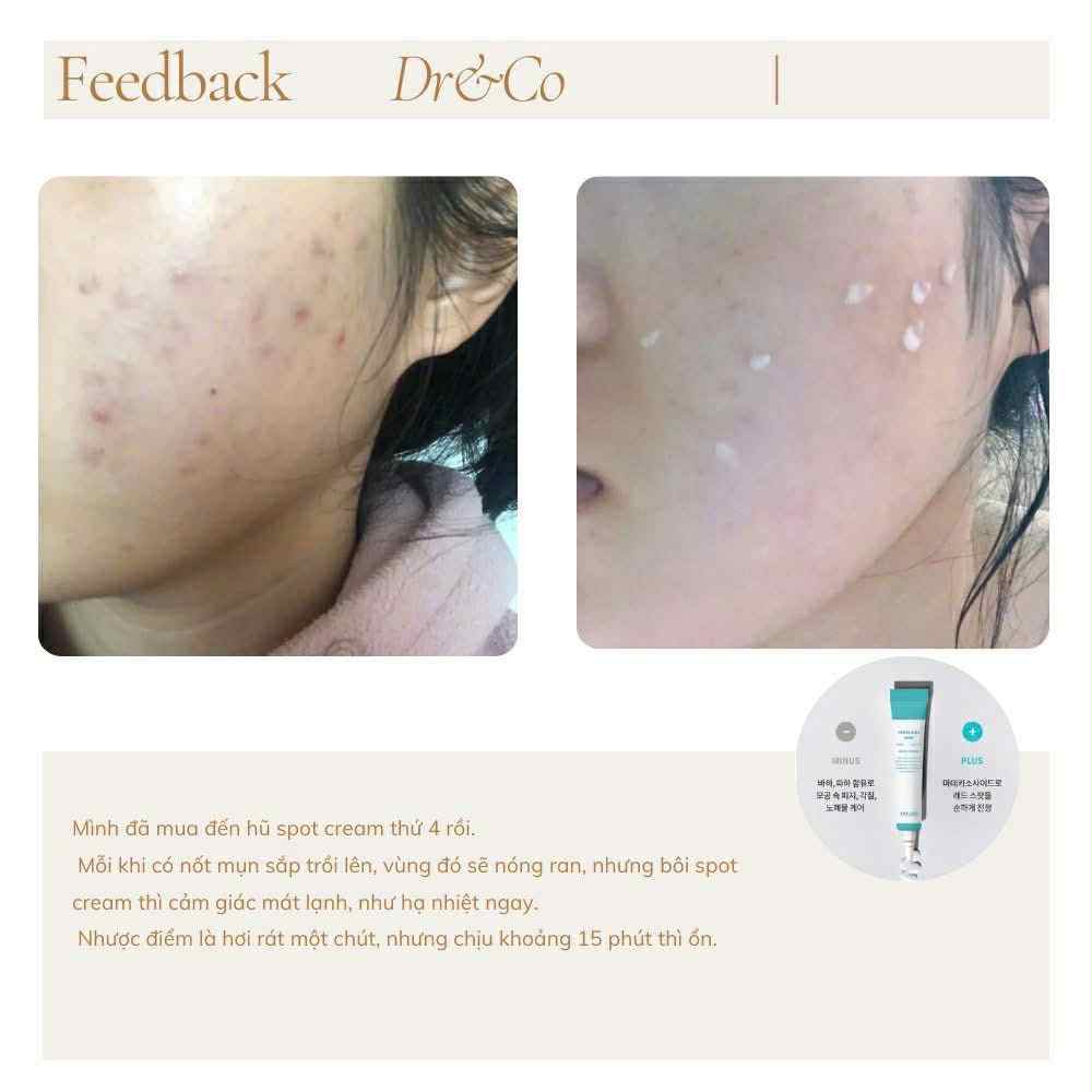 Triple CiCa Spot – Tinh chất chấm mụn mát lạnh- sản phẩm của viện da HQ