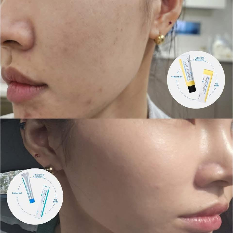 Combo CENOLA cream tái tạo phục hồi + chống nắng cho mọi loại da căng bóng không bắt nắng