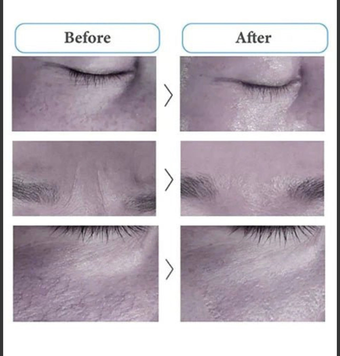 CONAPIDIL] Cemenzal Light Cream (100mL/3.38oz) – Maria Trinh Shop LLC