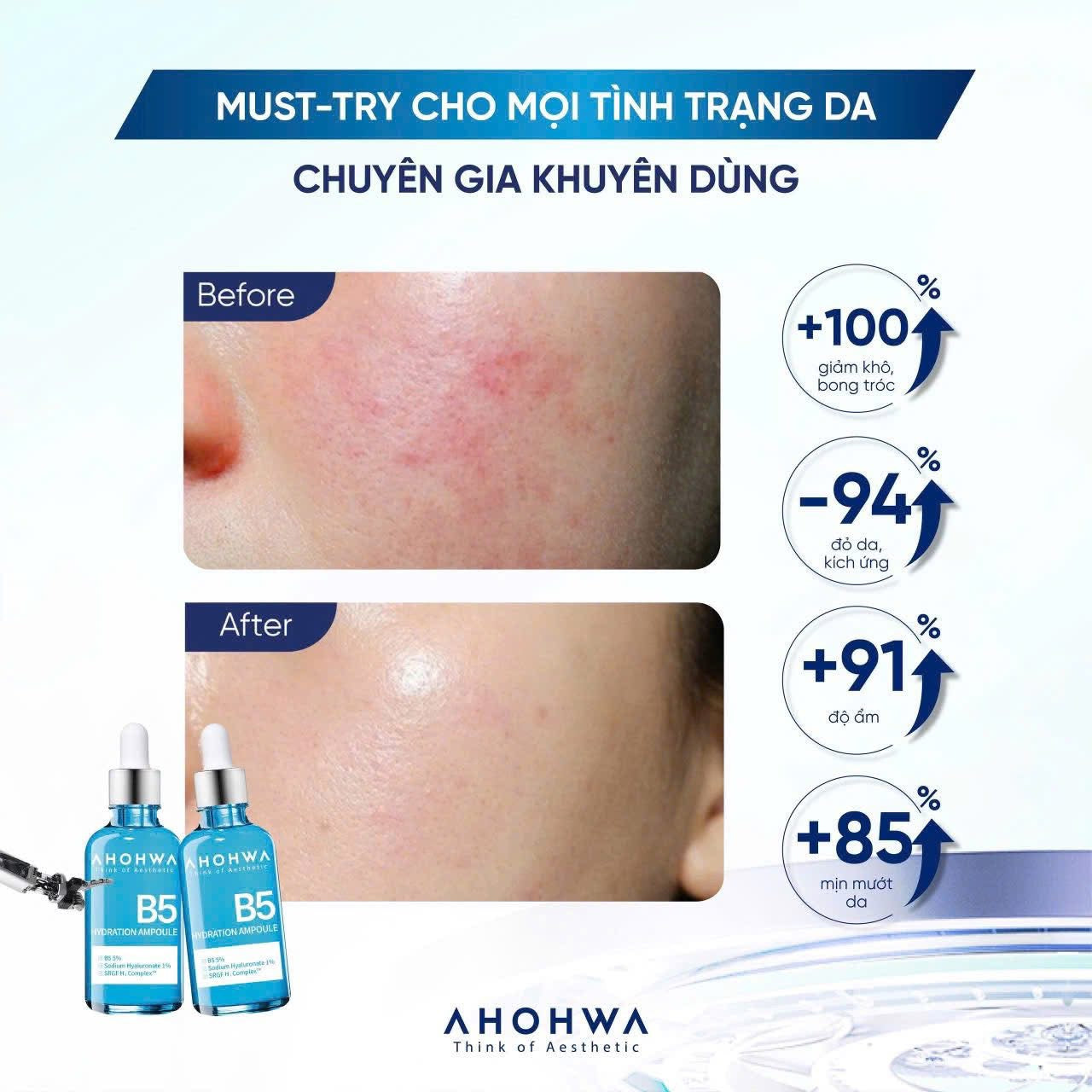 Combo ampoules serum B5 50ml & vitamin K