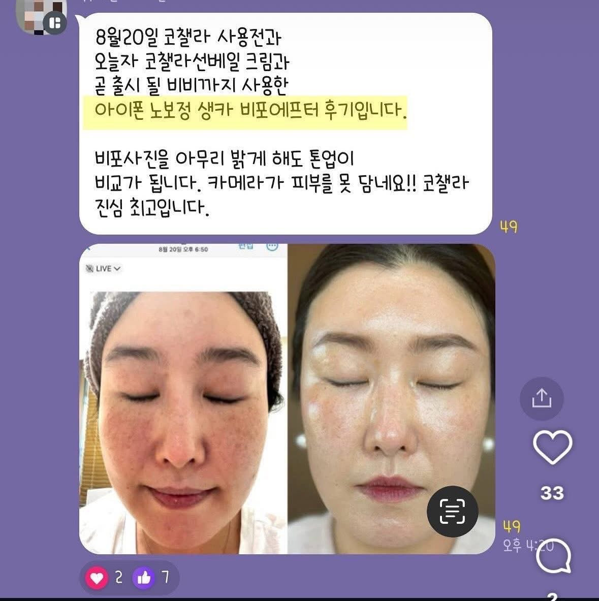 Cochalla set điều trị vấn đề da ngày đêm ngắn gọn bước mụn nám tàn nhang đốm nâu sắc tố