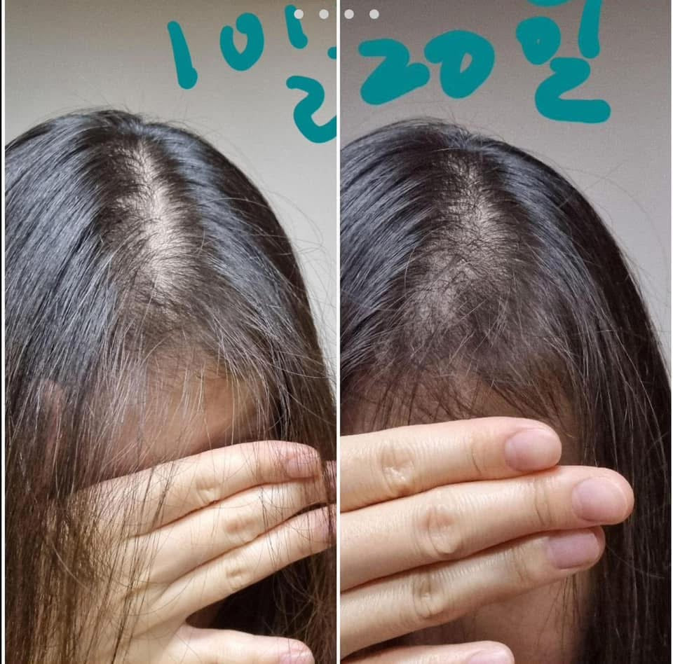 NoLa combo shampoo conditioner Treatment Korean