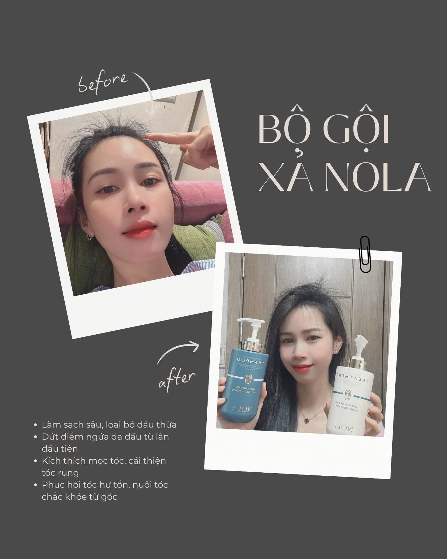 NoLa combo shampoo conditioner Treatment Korean