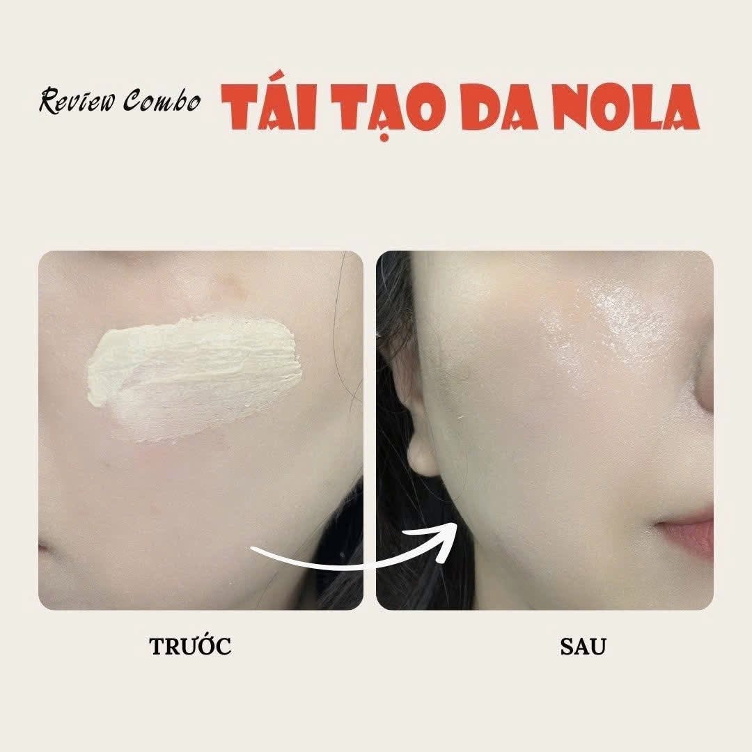 Combo CENOLA cream tái tạo phục hồi + chống nắng cho mọi loại da căng bóng không bắt nắng