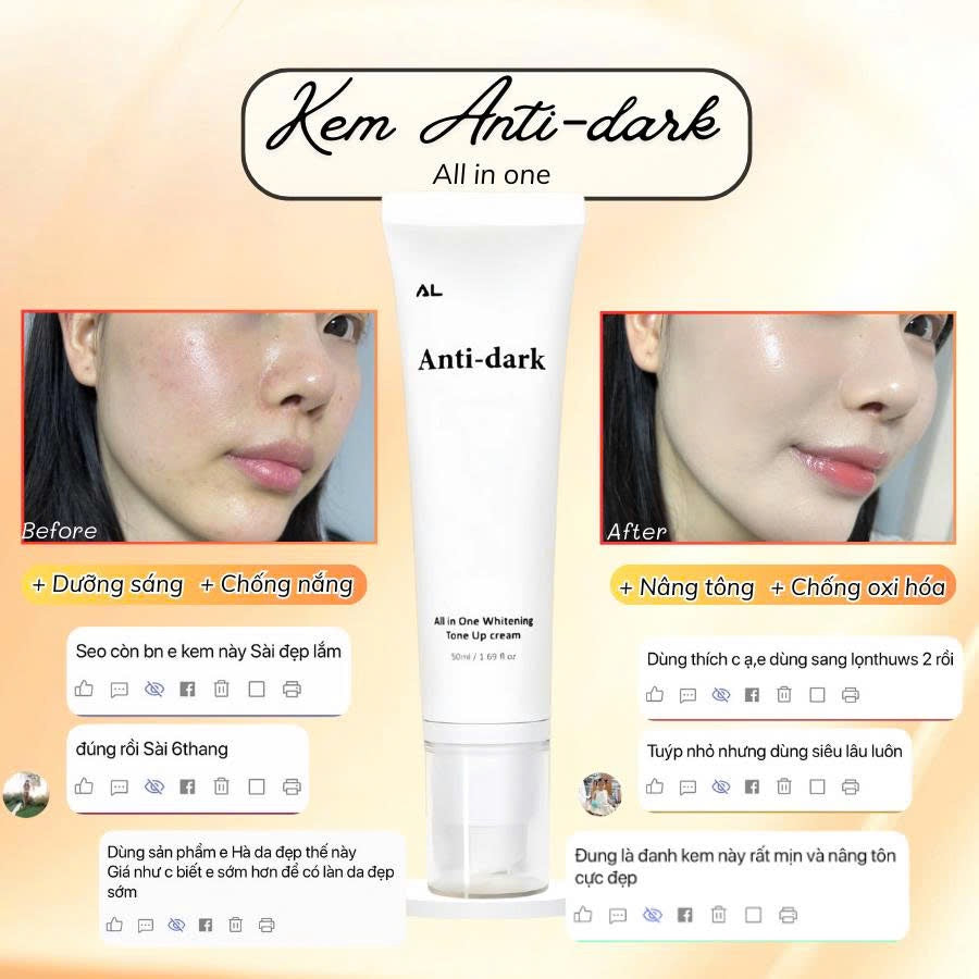 Anti Dark cream spf 30+ kem dưỡng ngày phù hợp mọi da dầu mụn nám sạm thâm - tone đẹp tệp màu da