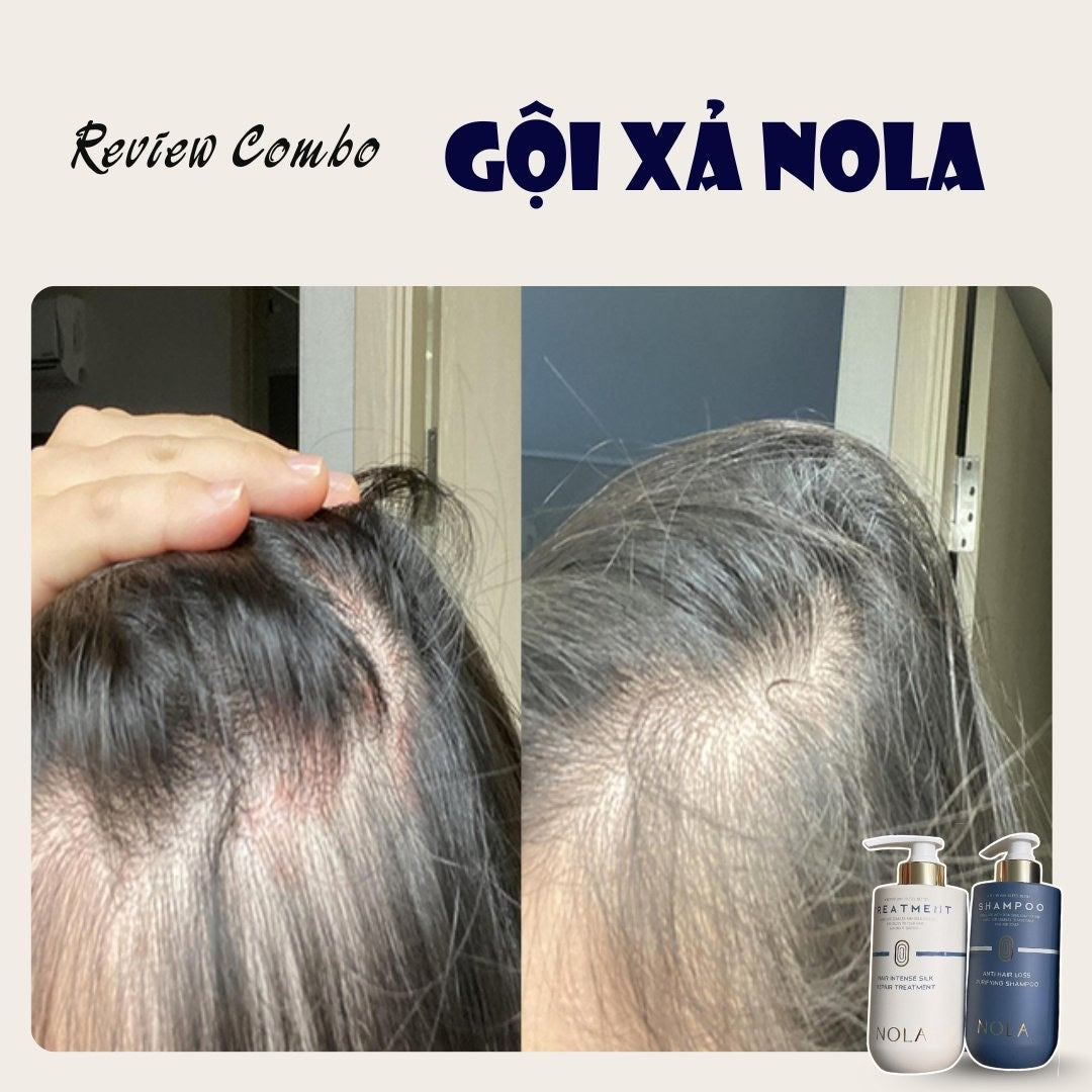 NoLa combo shampoo conditioner Treatment Korean