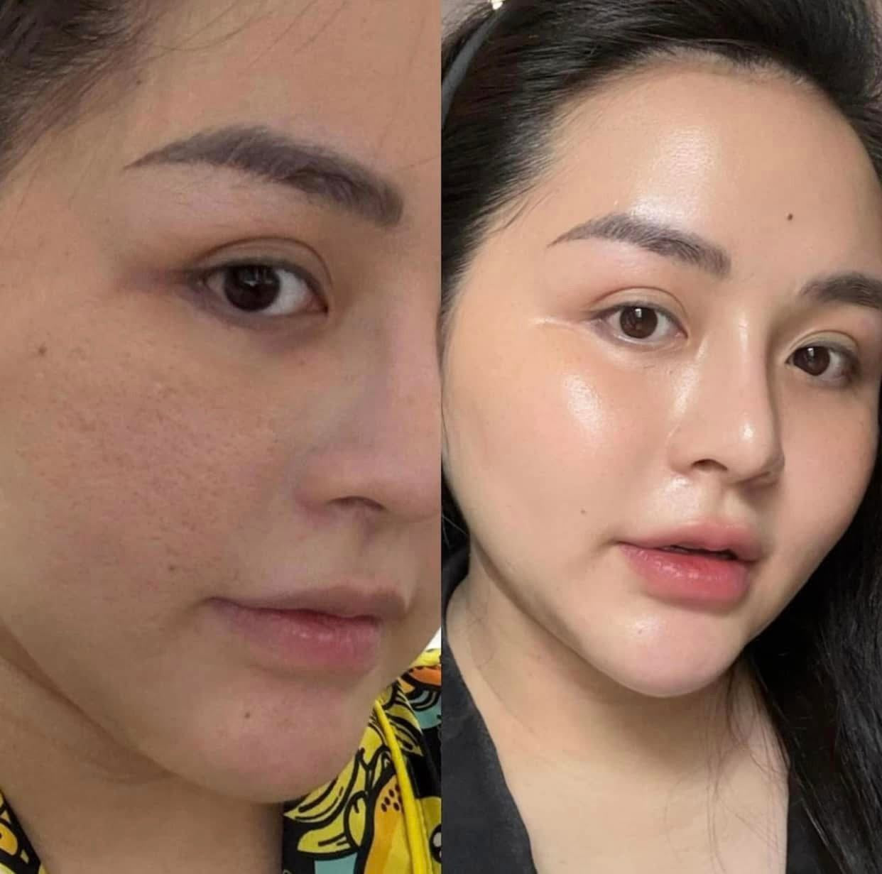 PAMS IBC 3X PDRN Enhance Cream - Kem tế bào gốc