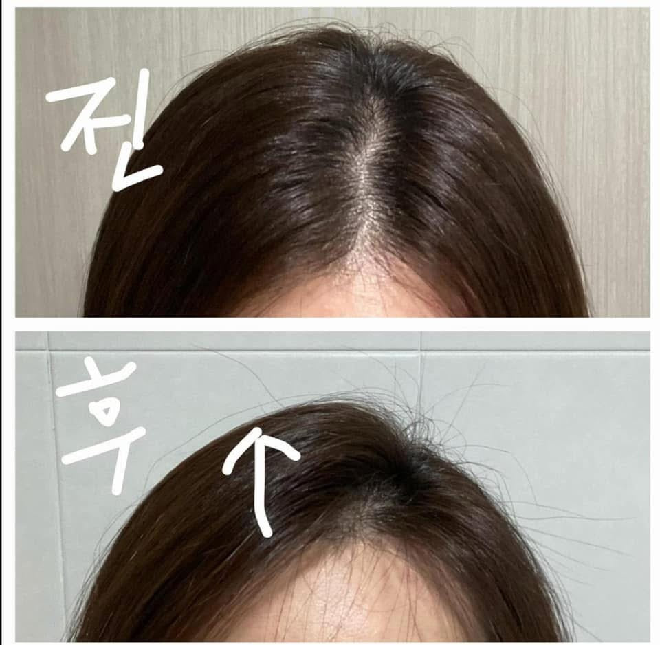 NoLa combo shampoo conditioner Treatment Korean