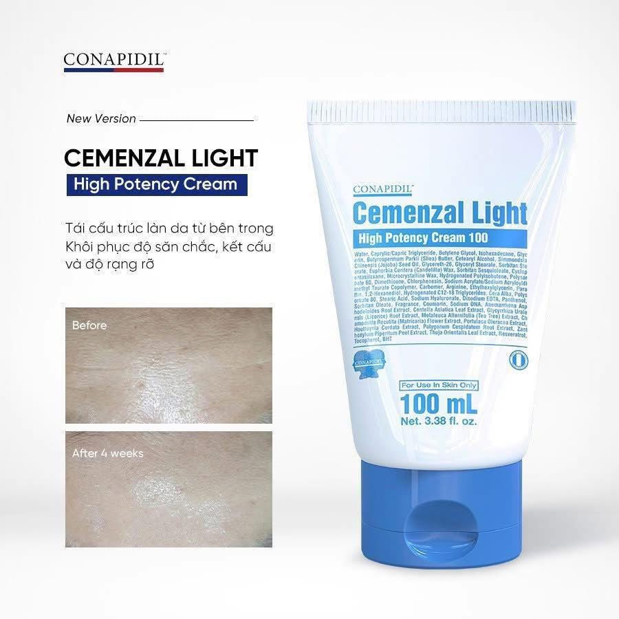 [CONAPIDIL] Cemenzal Light Cream (100mL/3.38oz)