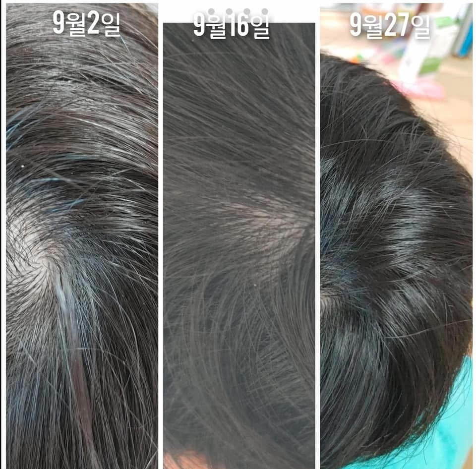 NoLa combo shampoo conditioner Treatment Korean